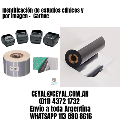 Identificación de estudios clínicos y por imagen –  Carhue