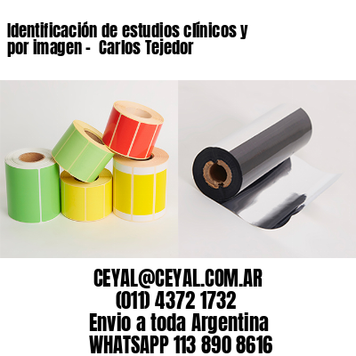 Identificación de estudios clínicos y por imagen –  Carlos Tejedor
