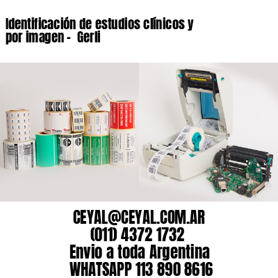 Identificación de estudios clínicos y por imagen –  Gerli